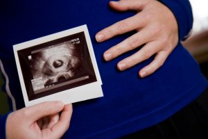combined trimester screening